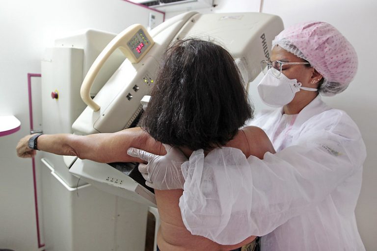 Uma mulher faz um exame de mamografia