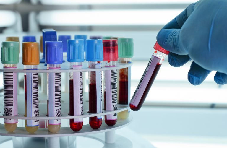 Saúde - geral - sangue - exame de sangue - laboratório