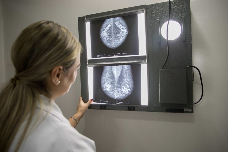 Médica olha uma mamografia